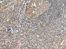 MOB2 Antibody - Immunohistochemistry of paraffin-embedded Human tonsil tissue  using MOB2 Polyclonal Antibody at dilution of 1:40(×200)