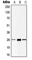 MOB2 Antibody - Western blot analysis of MOB2 expression in HepG2 (A); mouse liver (B); rat testis (C) whole cell lysates.