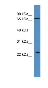 MOB3A / MOBKL2A Antibody - MOBKL2A antibody Western blot of THP-1 cell lysate. This image was taken for the unconjugated form of this product. Other forms have not been tested.