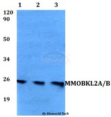MOB3A / MOBKL2A Antibody - Western blot of MMOBKL2A/B antibody at 1:500 dilution. Lane 1: HEK293T whole cell lysate. Lane 2: sp2/0 whole cell lysate. Lane 3: PC12 whole cell lysate.