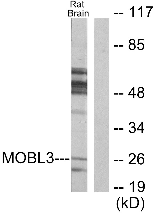 MOB4 / PHOCN Antibody - Western blot analysis of lysates from rat brain cells, using MOBL3 Antibody. The lane on the right is blocked with the synthesized peptide.