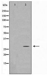 MOB4 / PHOCN Antibody - Western blot of rat brain cell lysate using MOBL3 Antibody