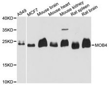 MOB4 / PHOCN Antibody - Western blot analysis of extracts of various cell lines, using MOB4 antibody at 1:3000 dilution. The secondary antibody used was an HRP Goat Anti-Rabbit IgG (H+L) at 1:10000 dilution. Lysates were loaded 25ug per lane and 3% nonfat dry milk in TBST was used for blocking. An ECL Kit was used for detection and the exposure time was 5s.