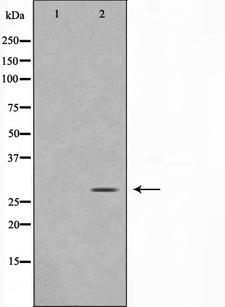 MOB4 / PHOCN Antibody - Western blot analysis on rat brain cell lysates using MOBL3 antibody. The lane on the left is treated with the antigen-specific peptide.