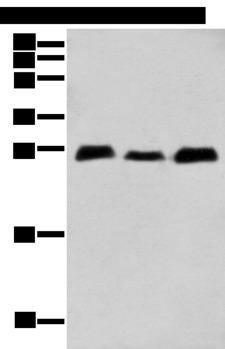 MOB4 / PHOCN Antibody - Western blot analysis of Human fetal brain tissue Human cerebrum tissue Mouse brain tissue  using MOB4 Polyclonal Antibody at dilution of 1:400