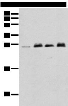 MOB4 / PHOCN Antibody - Western blot analysis of K-562 cell Mouse brain tissue Rat brain tissue Human fetal brain tissue  using MOB4 Polyclonal Antibody at dilution of 1:400