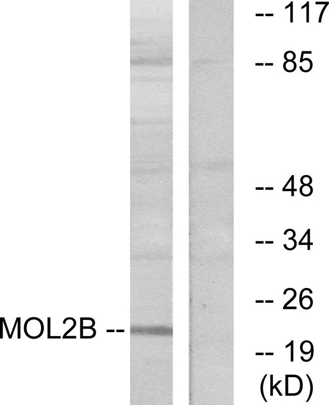 MOBKL2B / MOB3B Antibody - Western blot analysis of lysates from COLO cells, using MOBKL2B Antibody. The lane on the right is blocked with the synthesized peptide.