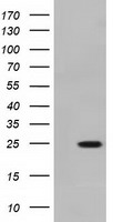 MOBKL2B / MOB3B Antibody - HEK293T cells were transfected with the pCMV6-ENTRY control (Left lane) or pCMV6-ENTRY MOBKL2B (Right lane) cDNA for 48 hrs and lysed. Equivalent amounts of cell lysates (5 ug per lane) were separated by SDS-PAGE and immunoblotted with anti-MOBKL2B.