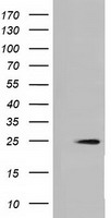 MOBKL2B / MOB3B Antibody - HEK293T cells were transfected with the pCMV6-ENTRY control (Left lane) or pCMV6-ENTRY MOBKL2B (Right lane) cDNA for 48 hrs and lysed. Equivalent amounts of cell lysates (5 ug per lane) were separated by SDS-PAGE and immunoblotted with anti-MOBKL2B.