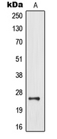 MOBKL2B / MOB3B Antibody - Western blot analysis of MOB3B expression in human brain (A) whole cell lysates.