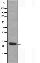 MOBKL2B / MOB3B Antibody - Western blot analysis of extracts of COLO cells using MOL2B antibody.