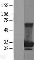 MOBKL2B / MOB3B Protein - Western validation with an anti-DDK antibody * L: Control HEK293 lysate R: Over-expression lysate