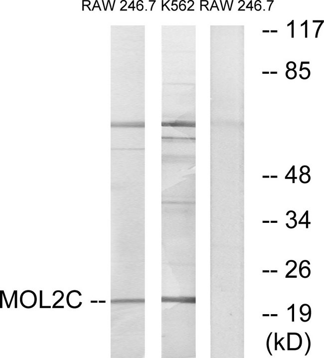 MOBKL2C / MOB3C Antibody - Western blot analysis of lysates from RAW264.7 and K562 cells, using MOL2C Antibody. The lane on the right is blocked with the synthesized peptide.