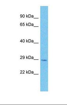 MOBKL2C / MOB3C Antibody - Western blot of Human RPMI-8226. MOB3C antibody dilution 1.0 ug/ml.  This image was taken for the unconjugated form of this product. Other forms have not been tested.