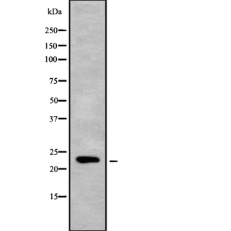 MOBKL2C / MOB3C Antibody - Western blot analysis of Mob3C using RAW264.7 whole cells lysates