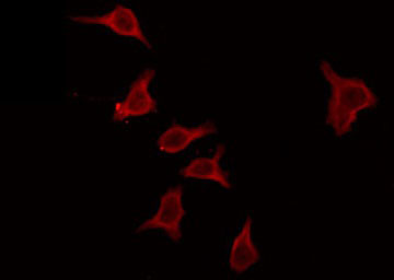 MOBKL2C / MOB3C Antibody - Staining RAW264.7 cells by IF/ICC. The samples were fixed with PFA and permeabilized in 0.1% Triton X-100, then blocked in 10% serum for 45 min at 25°C. The primary antibody was diluted at 1:200 and incubated with the sample for 1 hour at 37°C. An Alexa Fluor 594 conjugated goat anti-rabbit IgG (H+L) Ab, diluted at 1/600, was used as the secondary antibody.