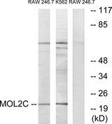 MOBKL2C / MOB3C Antibody - Western blot analysis of extracts from RAW264.7 cells and K562 cells, using MOL2C antibody.