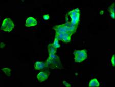 MOBP Antibody - Immunofluorescence staining of 293 cells at a dilution of 1:66, counter-stained with DAPI. The cells were fixed in 4% formaldehyde, permeabilized using 0.2% Triton X-100 and blocked in 10% normal Goat Serum. The cells were then incubated with the antibody overnight at 4 °C.The secondary antibody was Alexa Fluor 488-congugated AffiniPure Goat Anti-Rabbit IgG (H+L) .