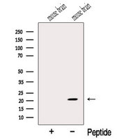 MOBP Antibody - Western blot analysis of extracts of mouse brain tissue using MOBP antibody. The lane on the left was treated with blocking peptide.