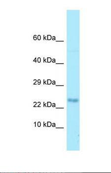 MOBP Antibody - Western blot of Human HCT15. MOBP antibody dilution 1.0 ug/ml.  This image was taken for the unconjugated form of this product. Other forms have not been tested.