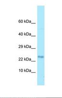MOBP Antibody - Western blot of Human HCT15. MOBP antibody dilution 1.0 ug/ml.  This image was taken for the unconjugated form of this product. Other forms have not been tested.