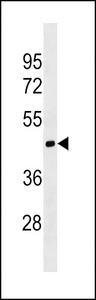 MOCS1 Antibody - MOCS1 Antibody western blot of CEM cell line lysates (35 ug/lane). The MOCS1 antibody detected the MOCS1 protein (arrow).