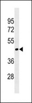 MOCS1 Antibody - MOCS1 Antibody western blot of CEM cell line lysates (35 ug/lane). The MOCS1 antibody detected the MOCS1 protein (arrow).