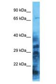MOCS1 Antibody - MOCS1 antibody Western Blot of HT1080. Antibody dilution: 1 ug/ml.  This image was taken for the unconjugated form of this product. Other forms have not been tested.