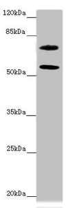 MOCS1 Antibody - Western blot All Lanes:MOCS1 antibody at 2.24 ug/ml + Jurkat whole cell lysate Secondary Goat polyclonal to rabbit IgG at 1/10000 dilution Predicted band size: 71,44,41,32,69,59 kDa Observed band size: 70,55 kDa
