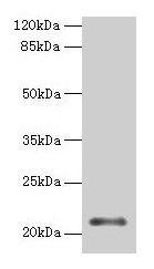 MOCS2 Antibody - Western blot All lanes: MOCS2 antibody at 2µg/ml Lane 1: Jurkat whole cell lysate Lane 2: 293T whole cell lysate Secondary Goat polyclonal to rabbit IgG at 1/10000 dilution Predicted band size: 21 kDa Observed band size: 21 kDa