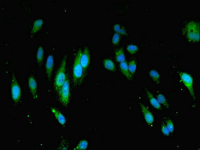 MOCS2 Antibody - Immunofluorescent analysis of Hela cells cells diluted at 1:100 and Alexa Fluor 488-congugated AffiniPure Goat Anti-Rabbit IgG(H+L)