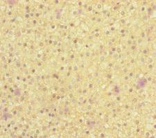 MOCS2 Antibody - Immunohistochemistry of paraffin-embedded human adrenal gland tissue at dilution of 1:100