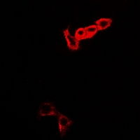 MOCS3 Antibody - Immunofluorescent analysis of MOCS3 staining in A549 cells. Formalin-fixed cells were permeabilized with 0.1% Triton X-100 in TBS for 5-10 minutes and blocked with 3% BSA-PBS for 30 minutes at room temperature. Cells were probed with the primary antibody in 3% BSA-PBS and incubated overnight at 4 deg C in a humidified chamber. Cells were washed with PBST and incubated with a DyLight 594-conjugated secondary antibody (red) in PBS at room temperature in the dark.