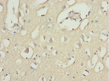 MOCS3 Antibody - Immunohistochemistry of paraffin-embedded human brain tissue at dilution 1:100