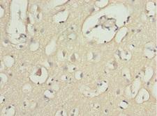 MOCS3 Antibody - Immunohistochemistry of paraffin-embedded human brain tissue at dilution 1:100