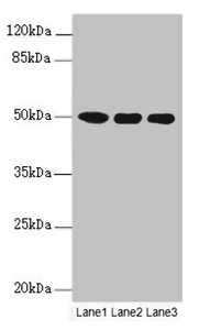 MOCS3 Antibody - Western blot All Lanes:MOCS3 antibody at 4.25ug/ml Lane 1 : A549 whole cell lysate Lane 2 : HepG-2 whole cell lysate Lane 3 : Jurkat whole cell lysate Secondary Goat polyclonal to Rabbit IgG at 1/10000 dilution Predicted band size: 50 kDa Observed band size: 50 kDa