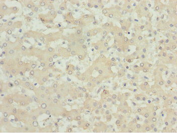 MOCS3 Antibody - Immunohistochemistry of paraffin-embedded human liver tissue at dilution 1:100