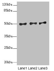 MOCS3 Antibody - Western blot All Lanes:MOCS3 antibody at 2.1ug/ml Lane 1 : A549 whole cell lysate Lane 2 : HepG-2 whole cell lysate Lane 3 : Jurkat whole cell lysate Secondary Goat polyclonal to Rabbit IgG at 1/10000 dilution Predicted band size: 50 kDa Observed band size: 50 kDa