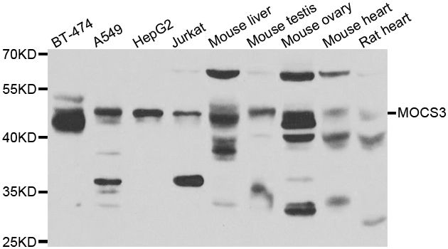 MOCS3 Antibody - Western blot analysis of extracts of various cell lines, using MOCS3 antibody at 1:1000 dilution. The secondary antibody used was an HRP Goat Anti-Rabbit IgG (H+L) at 1:10000 dilution. Lysates were loaded 25ug per lane and 3% nonfat dry milk in TBST was used for blocking. An ECL Kit was used for detection and the exposure time was 90s.