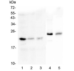 MOG Antibody - Western blot testing of 1) HEK293, 2) HK-2, 3) SGC-7901, 4) rat brain and 5) mouse brain lysate with MOG antibody at 0.5ug/ml. Expected molecular weight: 15-28 kDa depending on glycosylation level.