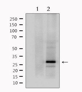 MOG Antibody - Western blot analysis of extracts of mouse brain tissue using MOG antibody. Lane 1 was treated with the antigen-specific peptide.