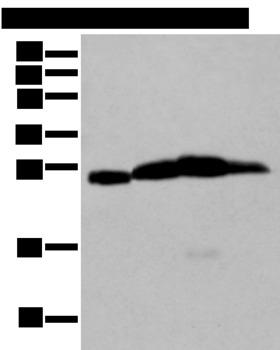 MOG Antibody - Western blot analysis of Mouse brain tissue Rat brain tissue Human cerebrum tissue Human cerebella tissue lysates  using MOG Polyclonal Antibody at dilution of 1:250