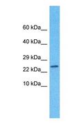 MOG1 / RANGRF Antibody - Western blot of MOG1 Antibody with human Fetal Kidney lysate.  This image was taken for the unconjugated form of this product. Other forms have not been tested.