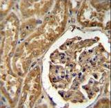 MOGAT1 / MGAT1 Antibody - MOGT1 Antibody immunohistochemistry of formalin-fixed and paraffin-embedded human kidney tissue followed by peroxidase-conjugated secondary antibody and DAB staining.