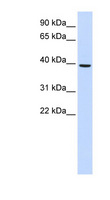 MOGAT2 Antibody - MOGAT2 antibody Western blot of Fetal Liver lysate. This image was taken for the unconjugated form of this product. Other forms have not been tested.