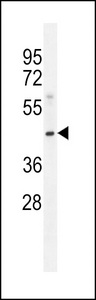 MOGAT3 Antibody - MOGT3 Antibody western blot of Jurkat cell line lysates (35 ug/lane). The MOGT3 antibody detected the MOGT3 protein (arrow).