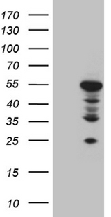 MOK / RAGE Antibody - HEK293T cells were transfected with the pCMV6-ENTRY control. (Left lane) or pCMV6-ENTRY RAGE. (Right lane) cDNA for 48 hrs and lysed. Equivalent amounts of cell lysates. (5 ug per lane) were separated by SDS-PAGE and immunoblotted with anti-RAGE. (1:2000)