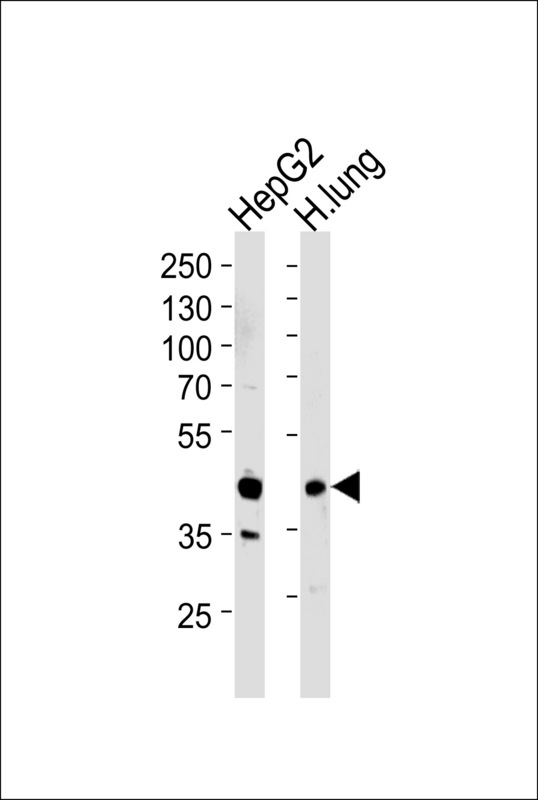 MOK / RAGE Antibody - Western blot of lysates from HepG2 cell line and human lung tissue lysates (from left to right), using RAGE Antibody. Antibody was diluted at 1:1000 at each lane. A goat anti-rabbit IgG H&L (HRP) at 1:5000 dilution was used as the secondary antibody. Lysates at 35ug per lane.
