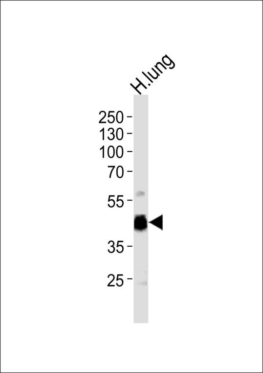 MOK / RAGE Antibody - Western blot of lysate from human lung tissue lysate, using RAGE Antibody. Antibody was diluted at 1:1000 at each lane. A goat anti-rabbit IgG H&L (HRP) at 1:5000 dilution was used as the secondary antibody. Lysate at 35ug per lane.