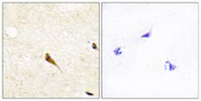 MOK / RAGE Antibody - Immunohistochemistry analysis of paraffin-embedded human brain tissue, using MOK Antibody. The picture on the right is blocked with the synthesized peptide.
